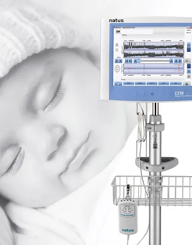 OBM - Monitor de Función Cerebral